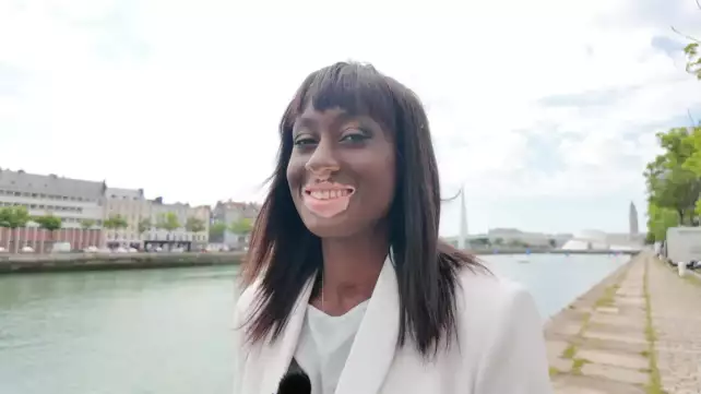 Estelle Mendy cette mannequin qui a fait de sa maladie une arme !