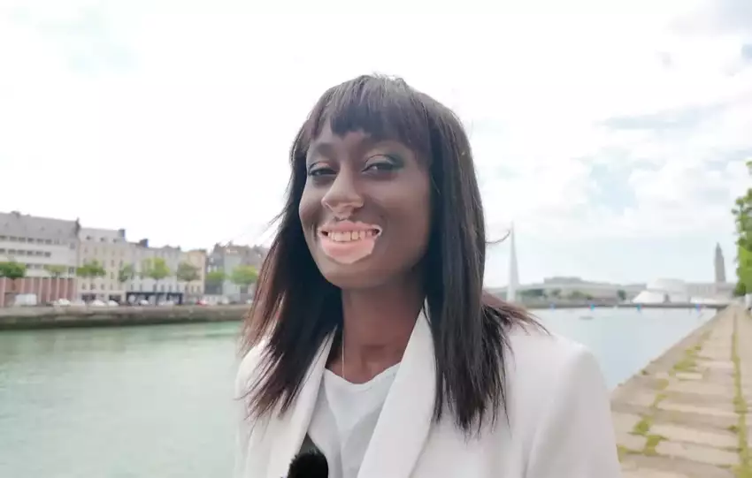 Estelle Mendy cette mannequin qui a fait de sa maladie une arme !