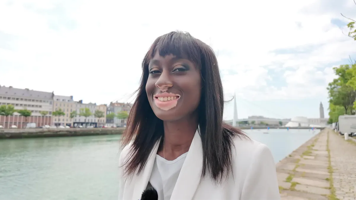 Estelle Mendy cette mannequin qui a fait de sa maladie une arme !